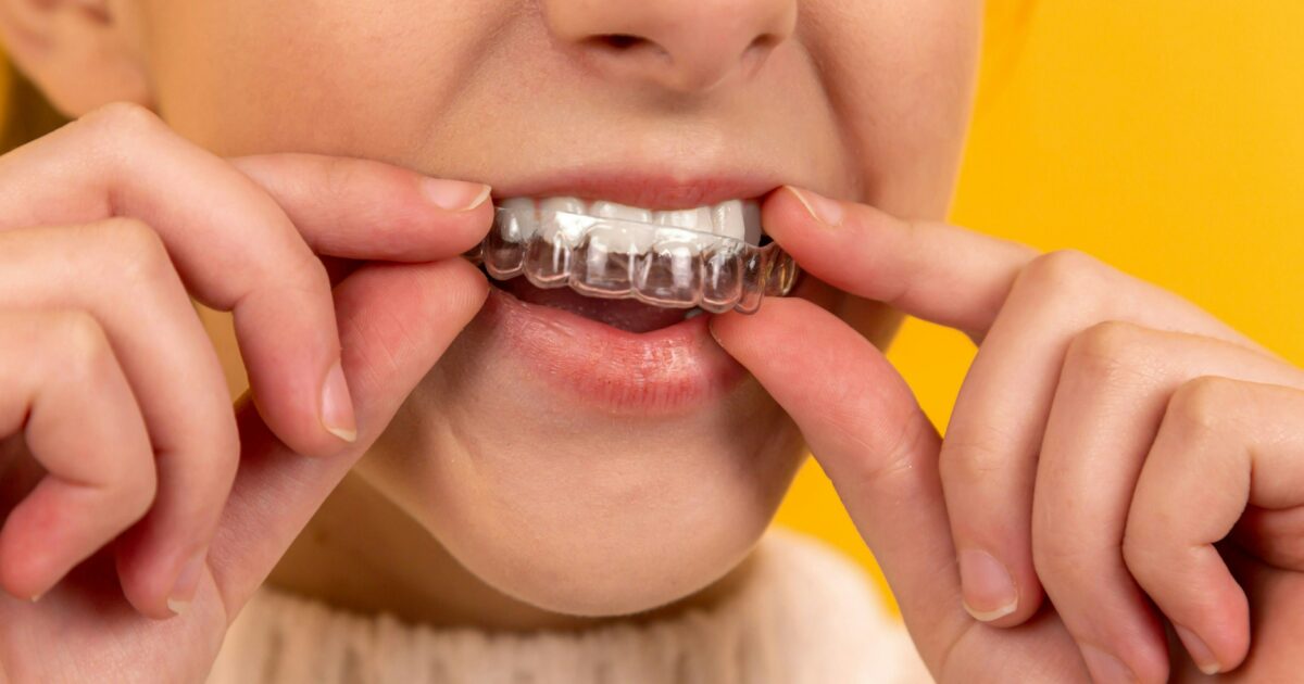 best Invisalign treatment in patuli,garia, kolkata