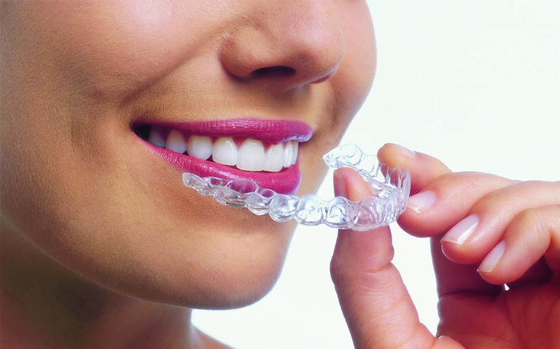 Dental Invisalign