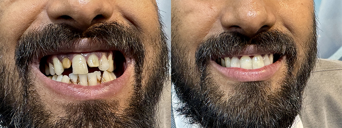 best dentist in patuli Implants in garia, patuli