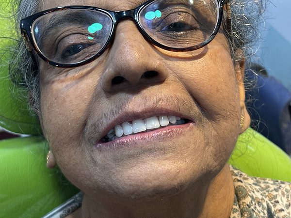 best Implants treatment in patuli,garia, kolkata