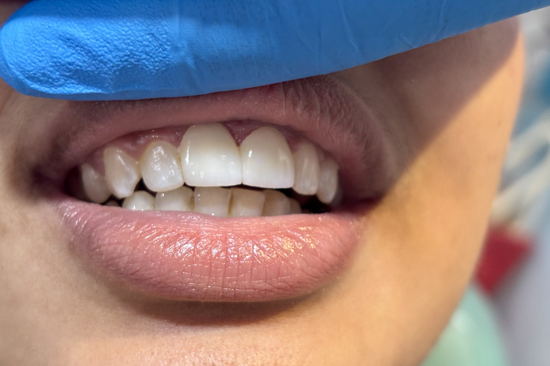 best Cosmetic treatment in patuli,rajpur sonarpur