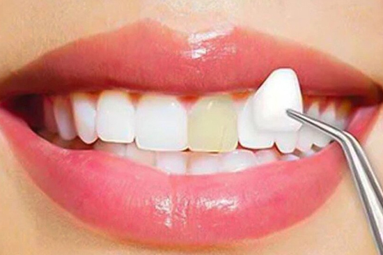 best Cosmetic treatment in patuli,rajpur sonarpur